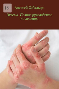 Экзема. Полное руководство по лечению